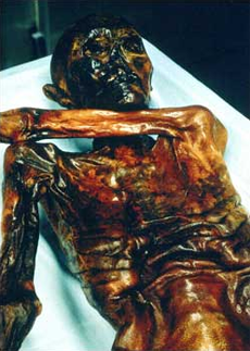 Homme de Similaun (Ötzi) : ...