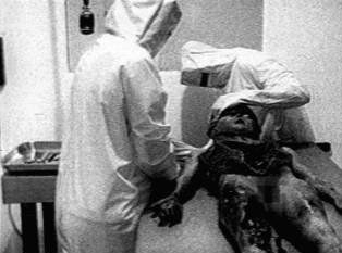 Rowell : Photographie tirée du film de l'autopsie de l'extraterrestre de Roswell, qui daterait de 1947.